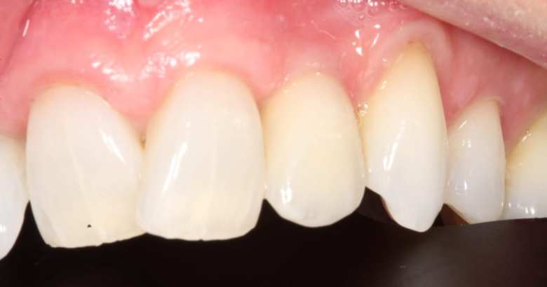 Website Before & Afters (1) Website Before & Afters (1)