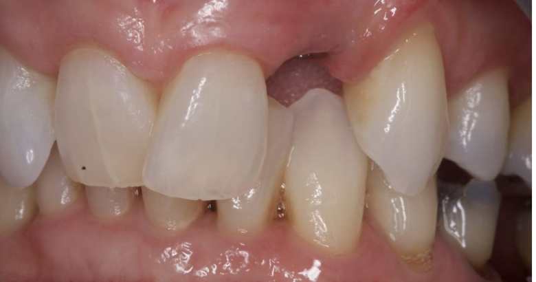 Website Before & Afters Website Before & Afters